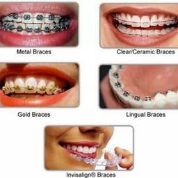 Dr.Mathesul Invisalign Orthodontist Braces Pune