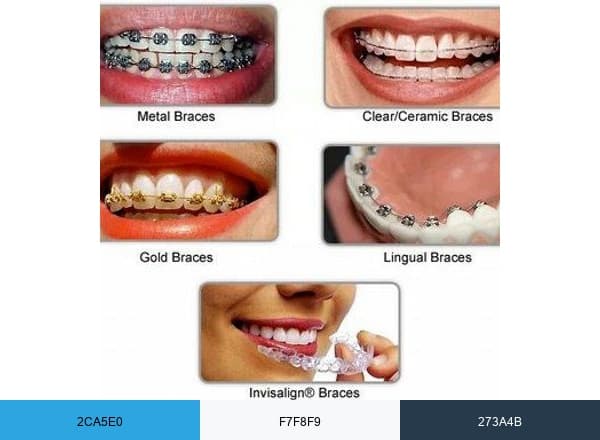 Dr.Mathesul Invisalign Orthodontist Braces Pune brand color palette